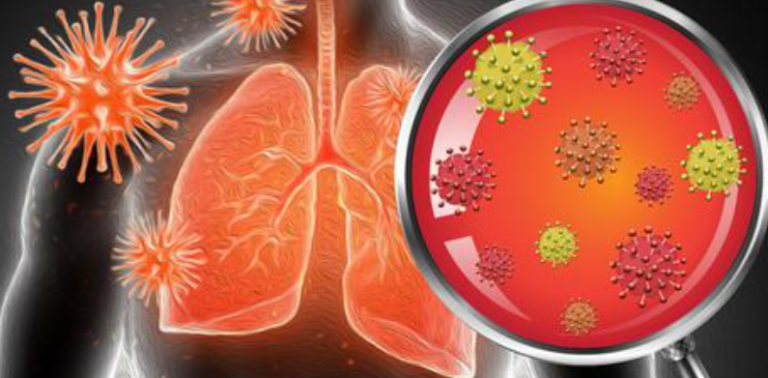 Pneumonia Ketika Paru-paru Mengalami Peradangan